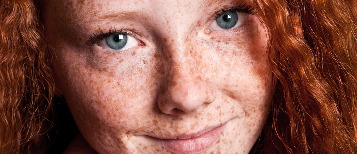 Lovely freckles